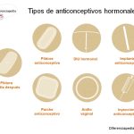 Esquema de los diferentes tipos de anticonceptivos hormonales